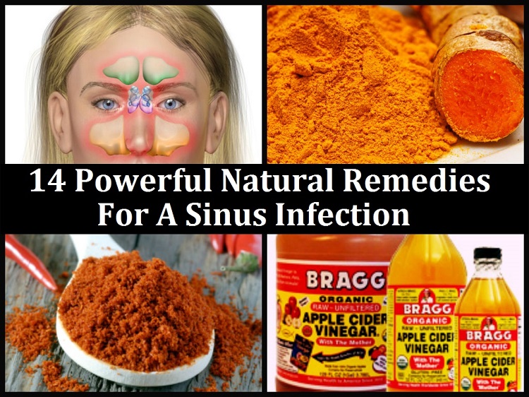 first-rate herbal remedy for continual sinusitis